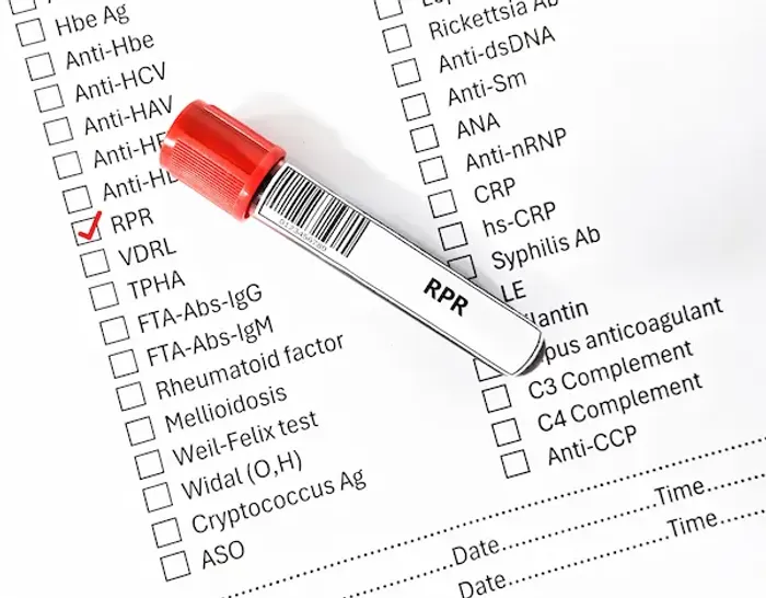 RPR Test Overview